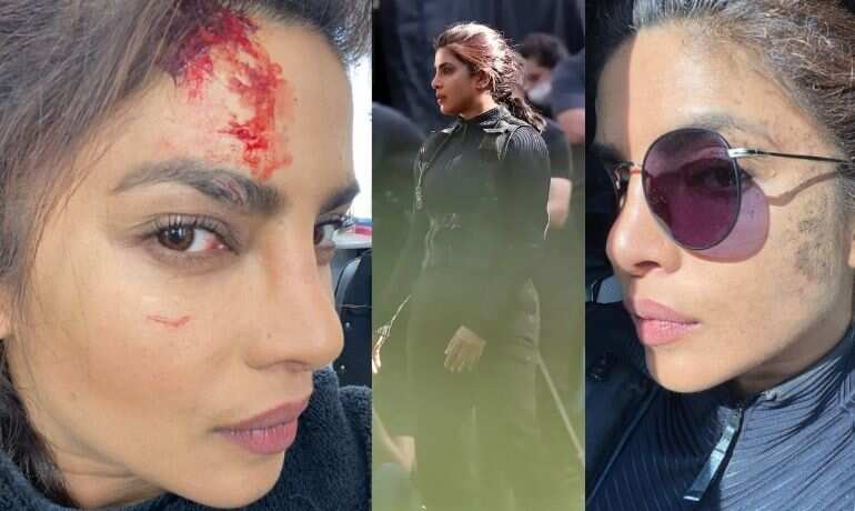 In pics: Priyanka Chopra Jonas rough & scratched look from 'Citadel' is out In pics: Priyanka Chopra Jonas rough & scratched look from 'Citadel' is out