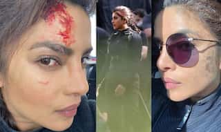 In pics: Priyanka Chopra Jonas rough & scratched look from 'Citadel' is out