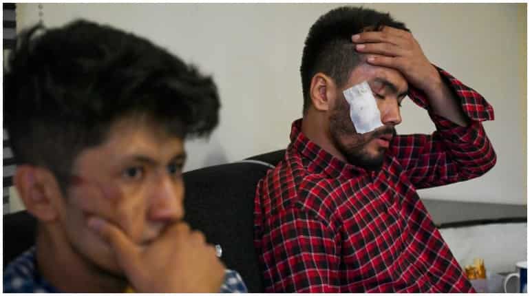 Taliban brutally flog and torture Afghan journalists for covering women's protests Taliban brutally flog and torture Afghan journalists for covering women's protests