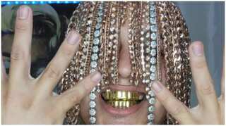 Rapper replaces his hair with gold chains through surgery