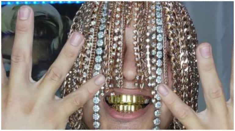 Rapper replaces his hair with gold chains through surgery