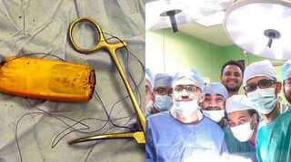 Egyptian man waits 6 months after swallowing a mobile phone