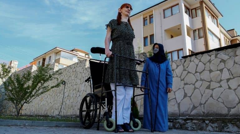 World's tallest woman says it's OK to stand out, hopes to use title to raise awareness about rare diseases World's tallest woman says it's OK to stand out, hopes to use title to raise awareness about rare diseases