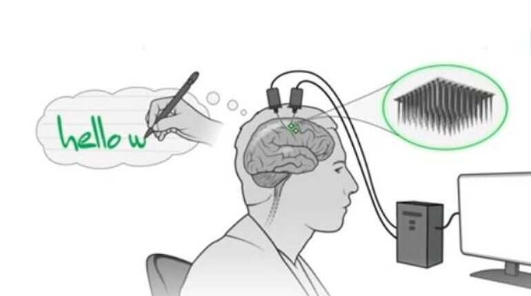 Watch | This device translates the thoughts of paralysed people into text with 94% accuracy