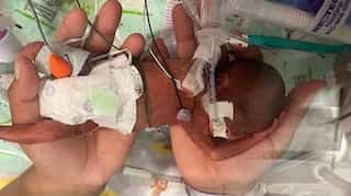 Boy in US state of Alabama sets record as most premature baby to survive