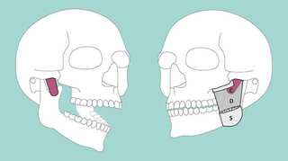 Scientists discover new muscle layer in human jaw that helps it in stabilisation