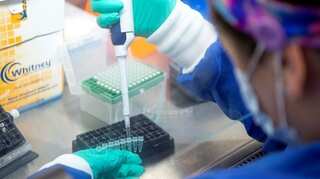Omicron less severe than other variants: Find out why?