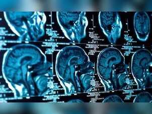 A new mystery illness? Canadian whistleblower warns of a disease affecting young adults
