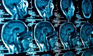 A new mystery illness? Canadian whistleblower warns of a disease affecting young adults