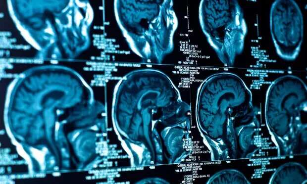 A new mystery illness? Canadian whistleblower warns of a disease affecting young adults
