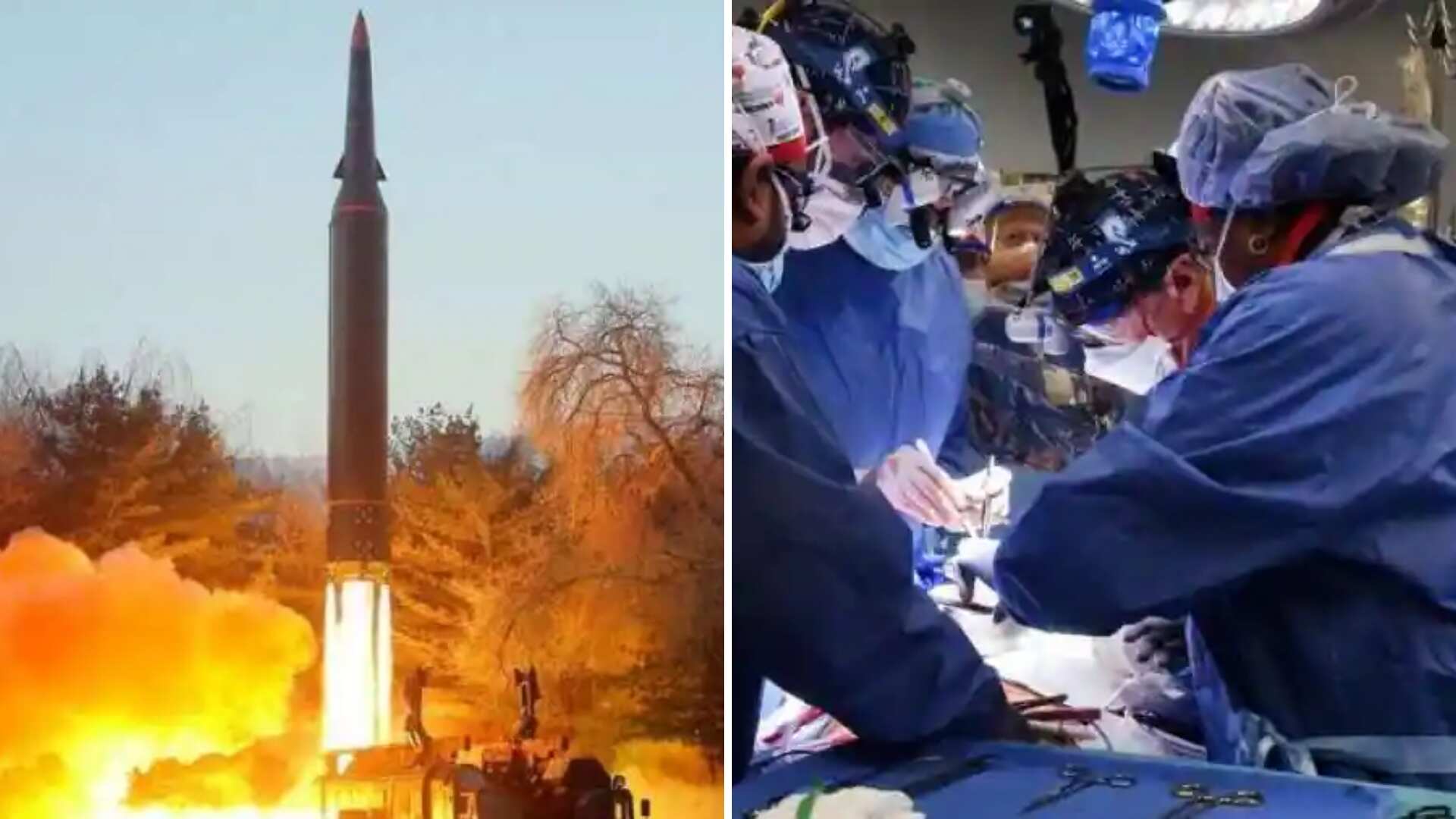 Morning news brief: North Korea tests another missile, transplant surgery and more