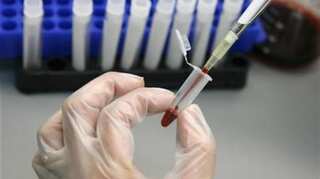 US researchers inch closer to 'Kick and Kill’ hidden HIV-infected cells, but how does it work?