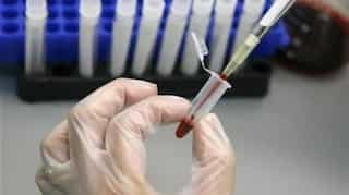 US researchers inch closer to 'Kick and Kill’ hidden HIV-infected cells, but how does it work?