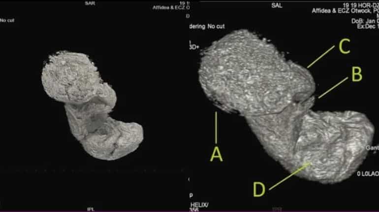 This 'pickled' fetus of an Egyptian mummy is baffling scientists