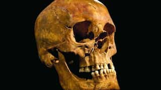 Evidence of first ear surgery found in 5,300-year-old skull, say archaeologists