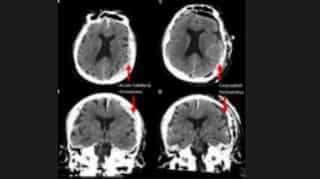 First ever scan of dying human brain shows astounding results