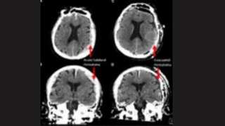 First ever scan of dying human brain shows astounding results