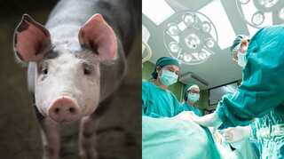 Explainer: Xenotransplantation - Will animal-to-human organ transplant succeed in the near future?