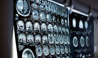 'I love my cool son': Brain implant helps fully paralysed man to spell out thoughts