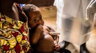 England detects four more cases of monkeypox infection