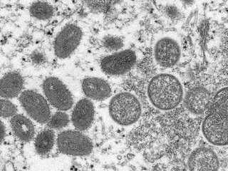 Certain individuals are much more at risk, says UK health body on monkeypox