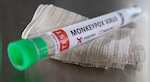 Monkeypox outbreak: UK detects 36 new cases after community transmission of virus