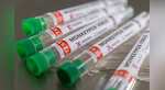 Can monkeypox be cured? UK scientists claim to have found potential wonder drug
