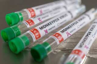 Monkeypox emergency could last months, with window closing to stop spread, experts say