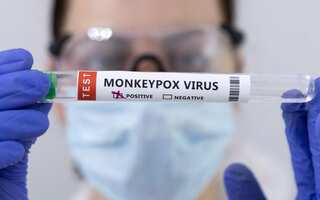 US health officials detect monkeypox virus among kids
