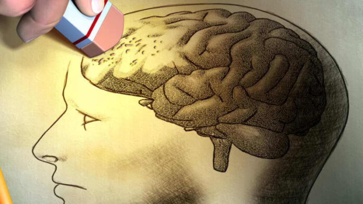 66-year-old Irish man suffers amnesia 10 minutes after sex with wife 66-year-old Irish man suffers amnesia 10 minutes after sex with wife