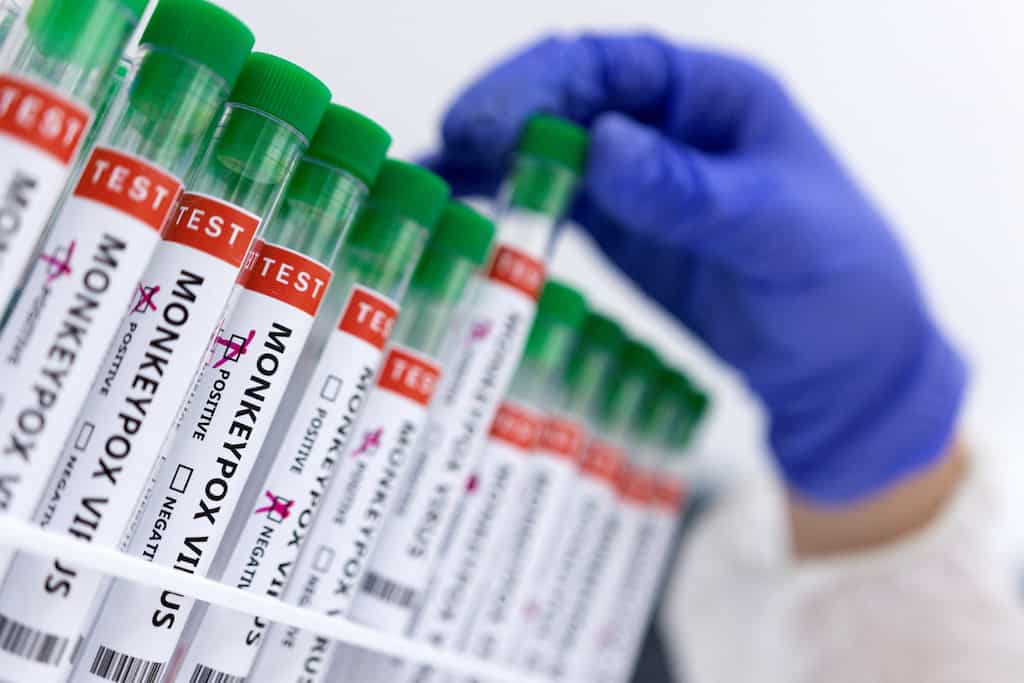 Monkeypox: 9 dead in Congo, first death in Nigeria in 2022