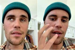 Justin Bieber illness video is heartbreaking, says UK patient with same condition