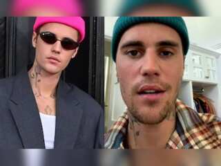 Justin Bieber reveals facial paralysis, pauses his World tour