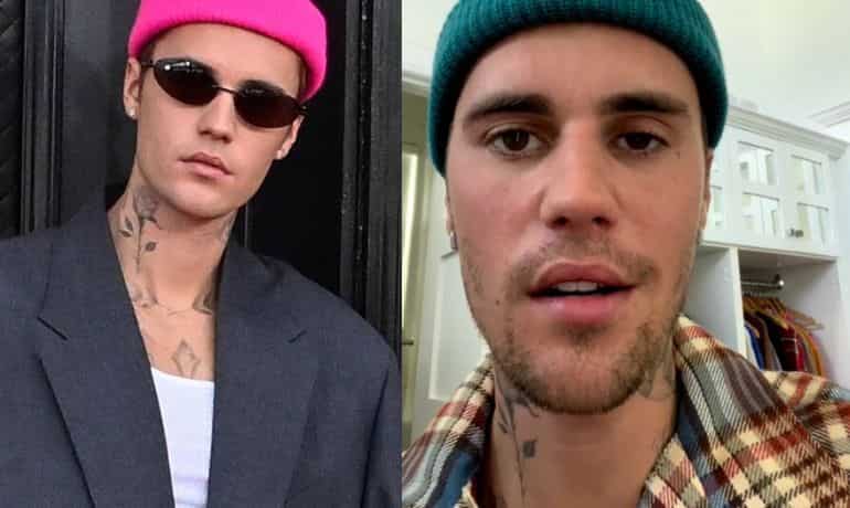 Justin Bieber reveals facial paralysis, pauses his World tour