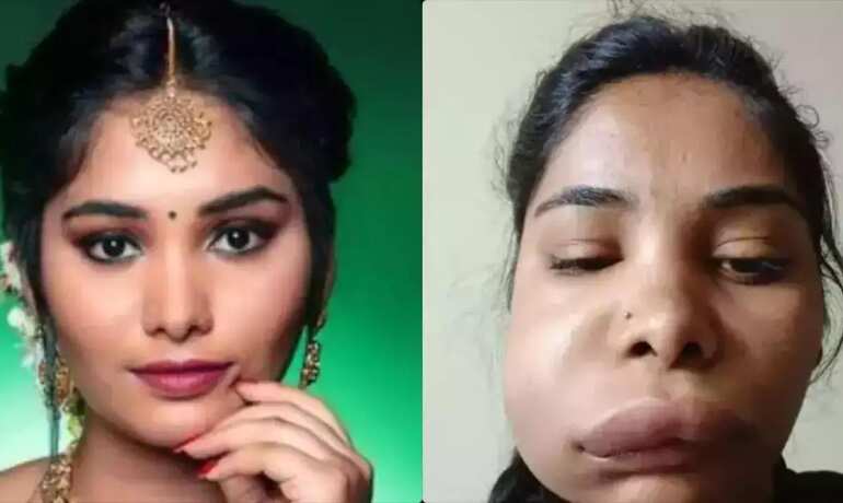 Indian actress Swathi Sathish root canal surgery goes wrong, netizens says nothing to worry