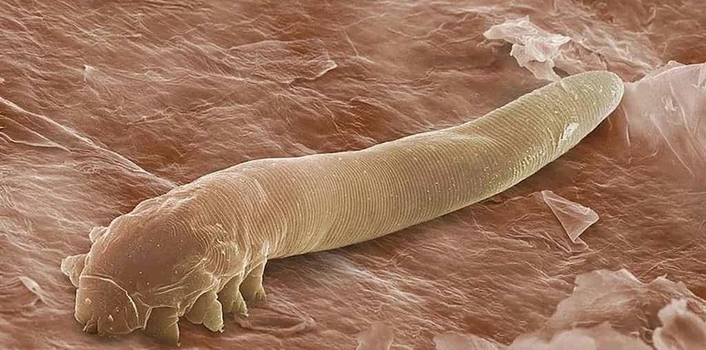 The tiny mites that have sex on our faces may go extinct
