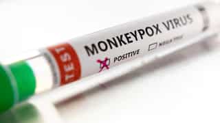 Russia reports first case of monkeypox