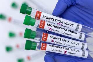 Monkeypox reaches India: First confirmed case reported in Kerala