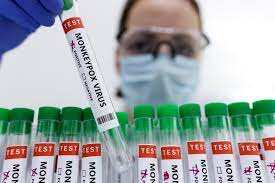 Monkeypox symptoms observed in UK different from pervious outbreaks: Lancet study