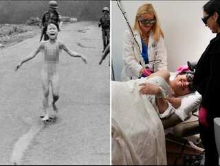Vietnam war’s 'Napalm Girl' receives final burns treatment, 50 years after iconic image