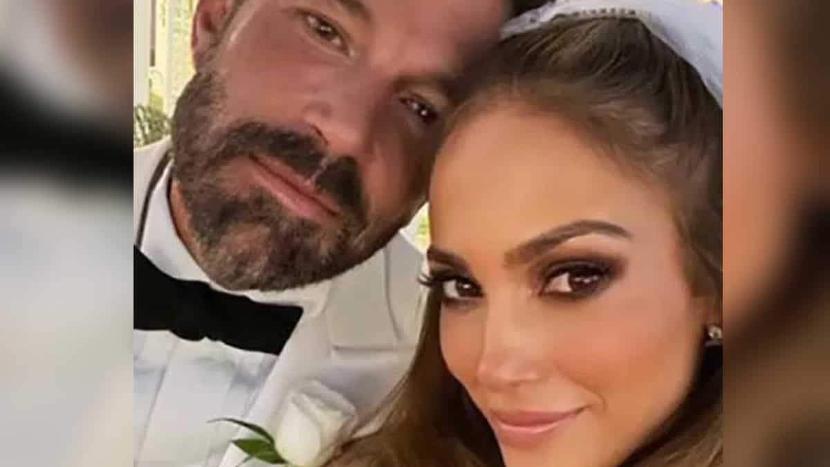 Our twenty years patient!