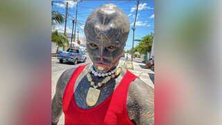 France’s ‘Black Alien’ struggling to make a living, opens up about hardships