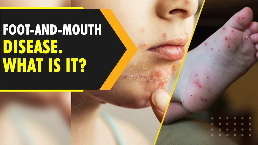 Foot-and-mouth disease is back. Here's what you should know