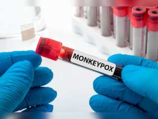 Delhi reports first case of Monkeypox; WHO declares global emergency