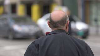 Researchers examining hair may have found a way to cure baldness and regenerate damaged organs
