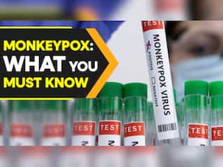 Monkeypox | Expert reveals what you must know