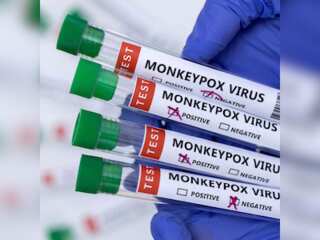 Spain reports the first Monkepox-related death in Europe