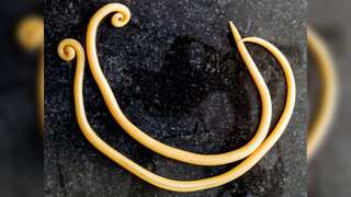 Four-year-old kid rushed to hospital after worm-infested food served at UK government's hostel for refugees