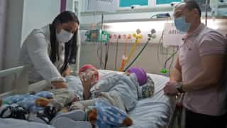 Brazilian doctors use virtual reality to separate conjoined twins