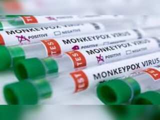 California records 827 Monkeypox cases, declares emergency